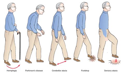 4. Attacker Pick People With _________ Gaits.