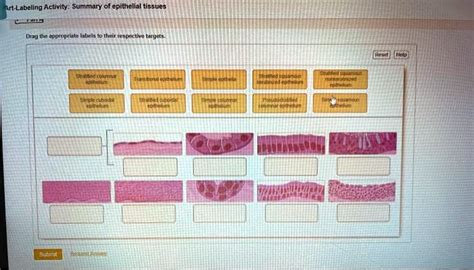 Art-labeling Activity Summary Of Epithelial Tissues