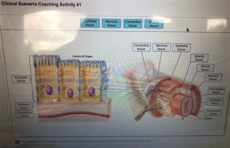 Chapter 4 Clinical Scenario Coaching Activity 1