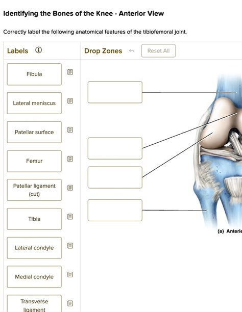 Correctly Label The Following Anatomical Features Of The Tibiofemoral Joint