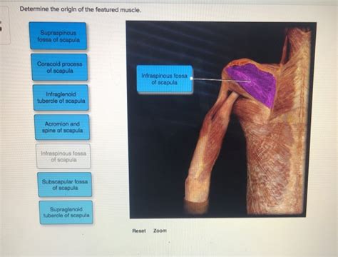 Determine Which Is The Correct Action Of The Featured Muscle