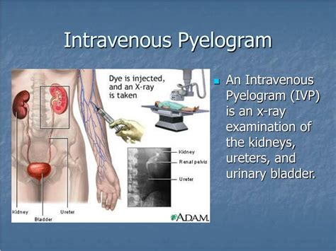 Finding The Natural Response Of A Ivp