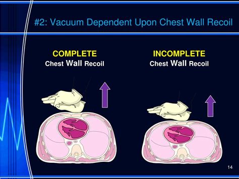 How Does Complete Chest Recoil Contribute To Effective Cpr