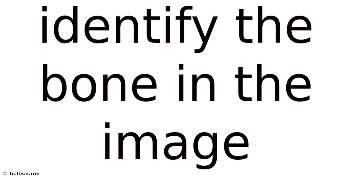 Identify The Bone In The Image