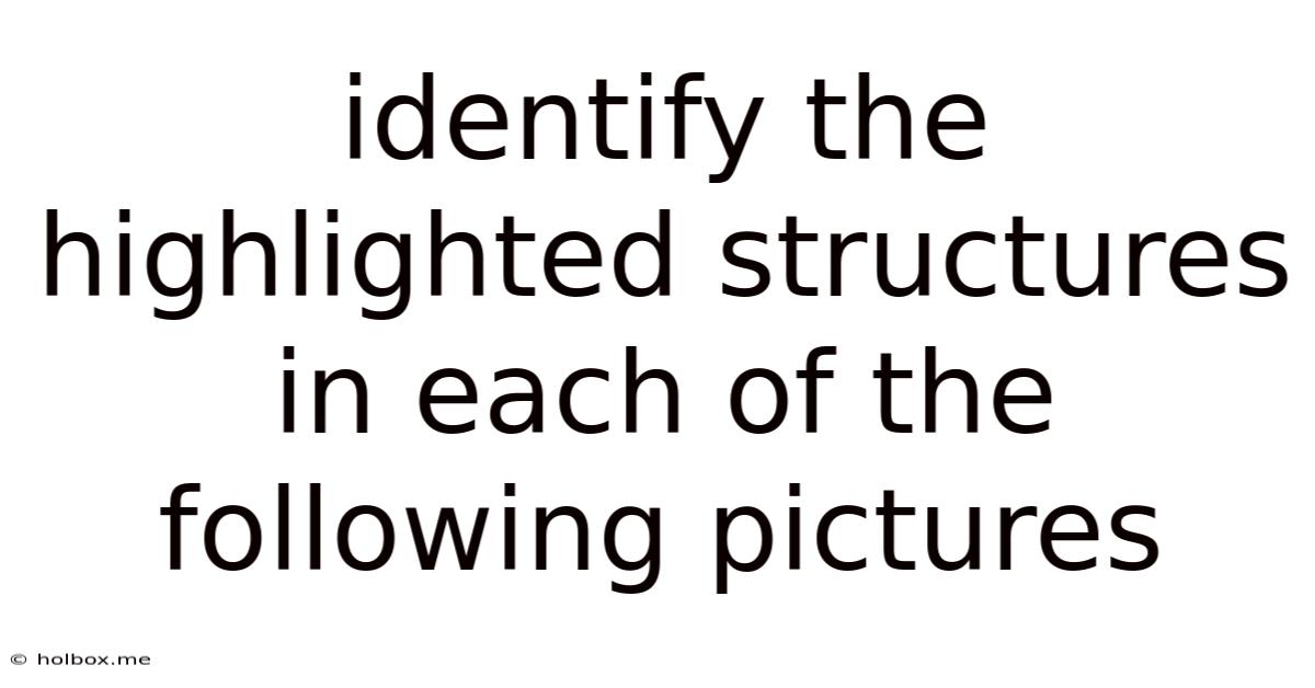 Identify The Highlighted Structures In Each Of The Following Pictures