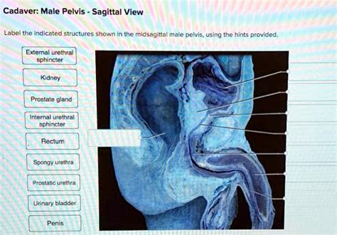 If Asked To Analyze The Structures Of A Cadaver.