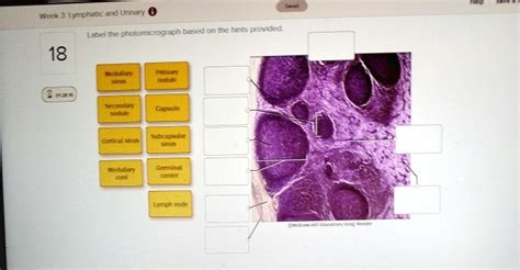 Label The Photomicrograph Based On The Hints Provided.