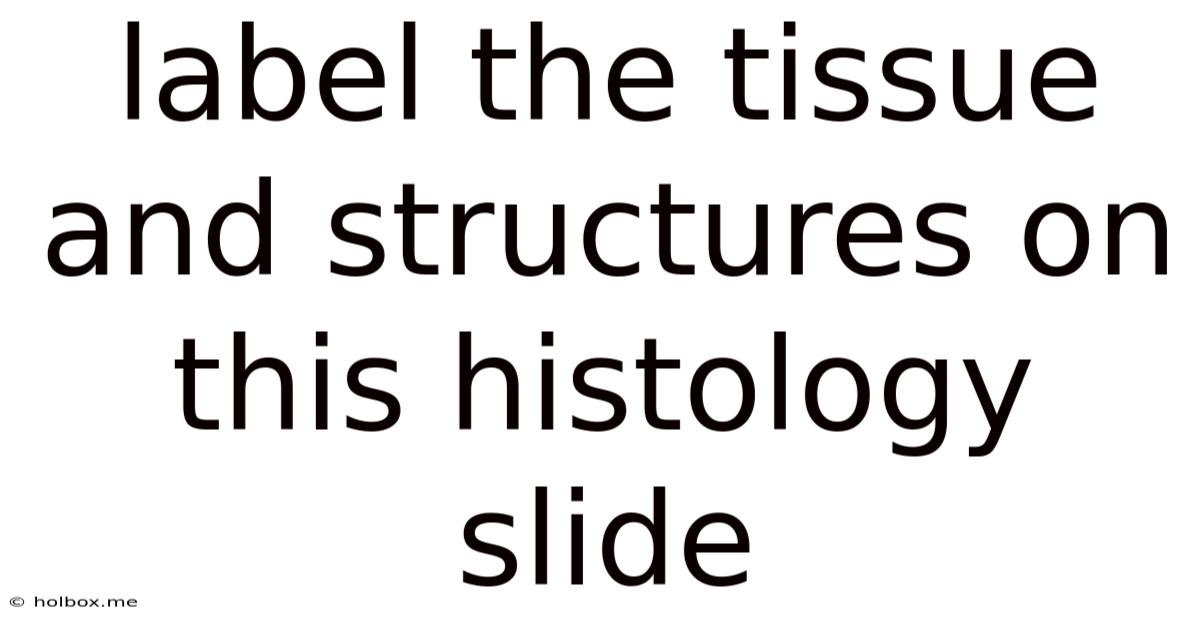 Label The Tissue And Structures On This Histology Slide