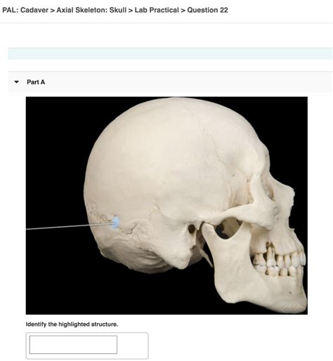 Pal Cadaver Axial Skeleton Skull Lab Practical Question 11