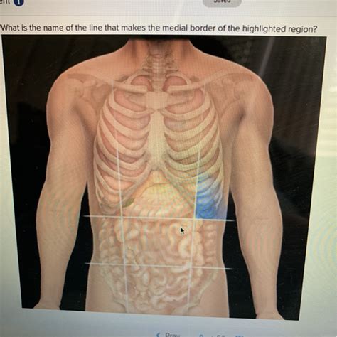 What Is The Medial Border Of The Highlighted Region Called