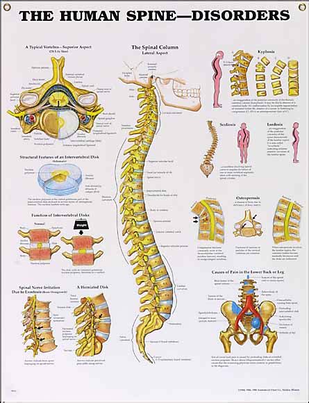 Which Of The Following Disorders Involves The Vertebrae