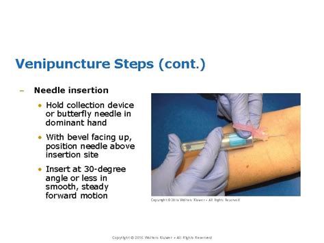 Which Statement Is True Regarding Venipuncture Procedures In Mice: