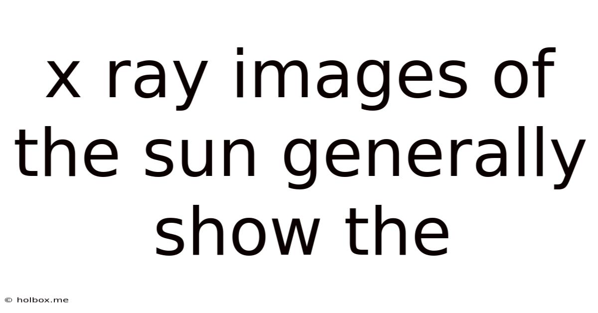 X Ray Images Of The Sun Generally Show The
